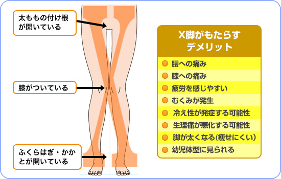 膝 の 痛み 原因 症状