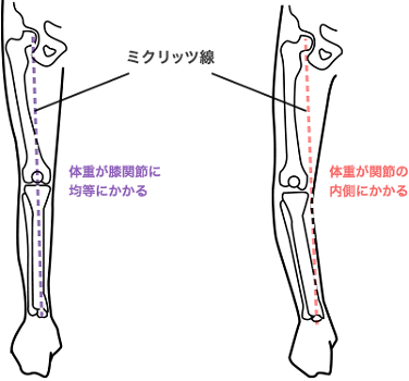 膝 の 痛み 原因 症状